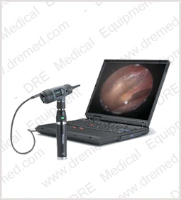 Welch Allyn Digital MacroView Otoscope